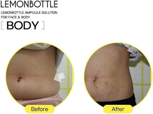 بطری لیمو لیپولایب لیپولیز از دست دادن وزن از دست دادن چربی بطری لیمو